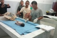 Penemuan jasad bayi di pekarangan rumah Aek Galoga, Kec. Panyabungan, Kab. Madina saat di evakuasi ke RSUD Panyabungan.